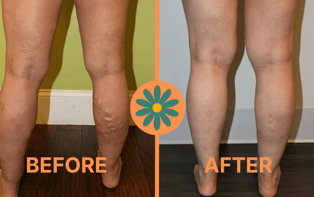 Althéa™ Advanced Wide Compression Socks For Pain Relief - Ma boutique